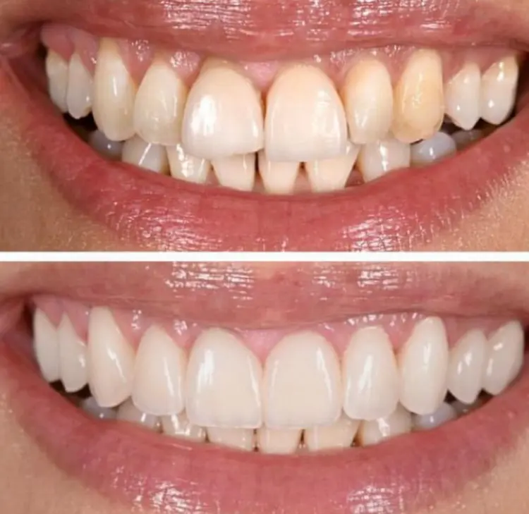 Before-After-Image-1
