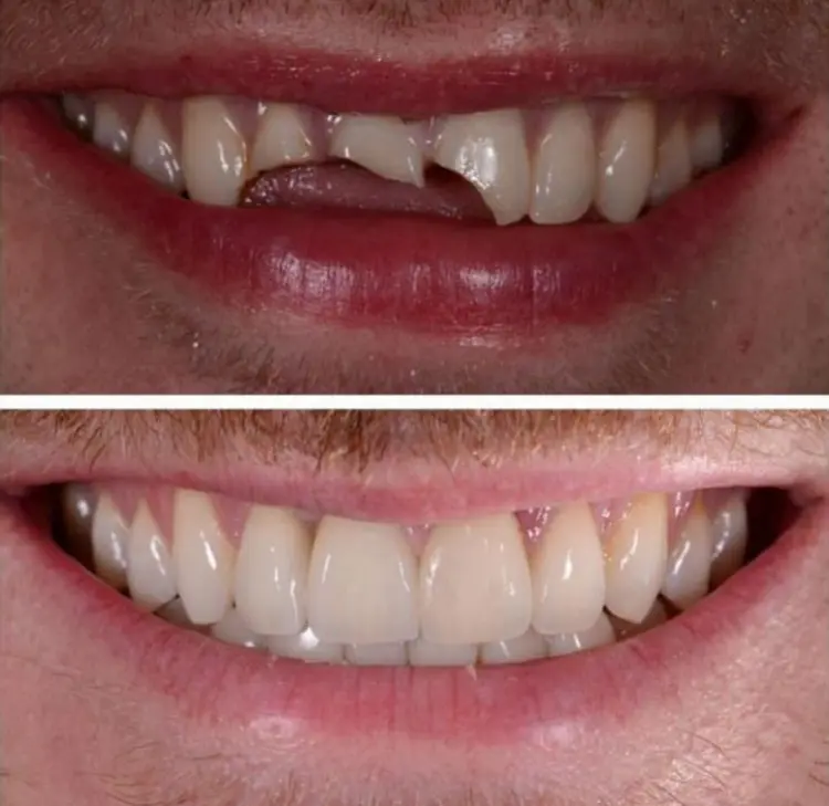 Before-After-Image-3