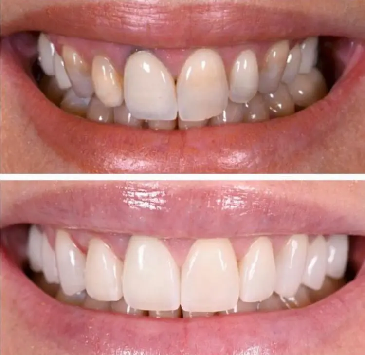 Before-After-Image-4