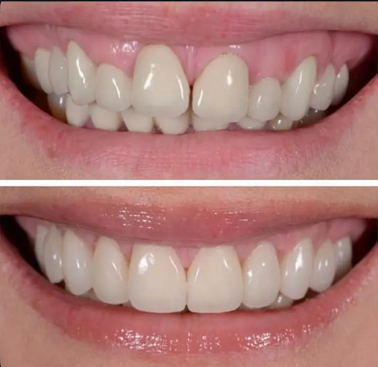 Before-After-Image-5